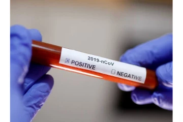 2 ஆயிரத்துக்கும் கீழ் குறைந்த கொரோனா பாதிப்பு - இன்றைய முழு நிலவரம்