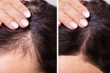 சட்டு சட்டுனு முடி உடையுதா? உடனே தடுக்க இந்த ஒரே ஒரு பொருள் போதும்!