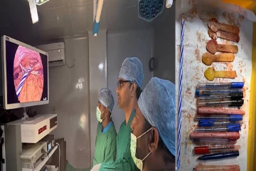 பெண்ணின் வயிற்றில் 14 பேனாக்கள், 5 கரண்டிகள், மெழுகுவர்த்தி! அறுவை சிகிச்சையில் அதிர்ச்சி