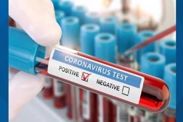 வவுனியாவில் மேலும் 67 பேருக்கு கோவிட் தொற்று உறுதி