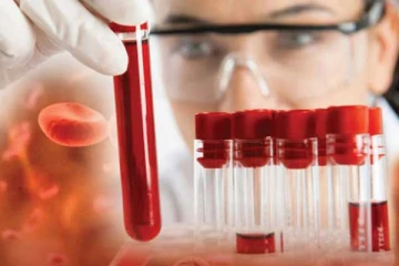 ශ්‍රී ලංකාව තුළ තැලසීමියා වාහකයින්ගේ සීඝ්‍ර වැඩිවීමක්