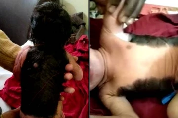 உடம்பு முழுவதும் முடியுடன் பிறந்துள்ள விசித்திர குழந்தை! அப்பட்டமாக உண்மையை உடைத்த மருத்துவர்