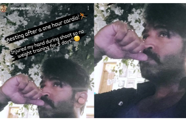 காயமடைந்த நடிகர் அருண் விஜய்.. வெளியான ஷாக்கிங் நியூஸ் | Arun Vijay Had Accident In Shooting
