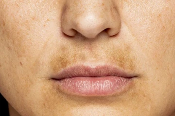 ஒரு சிட்டிகை மஞ்சள் இருந்தால் போதும்.. உதடுகளுக்கு மேலே உள்ள கருமை மாறிவிடும்