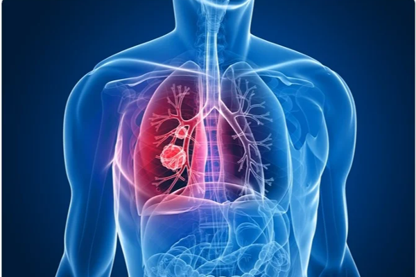 புற்றுநோயை முழுமையாக குணப்படுத்தும் மருந்து கண்டுபிடிப்பு | Discovery Of A Drug Can Completely Cure Cancer