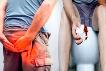 மூலநோயினால் இவ்வளவு பாதிப்பு ஏற்படுமா? 40 வயதை கடப்பவர்களுக்கான எச்சரிக்கை!