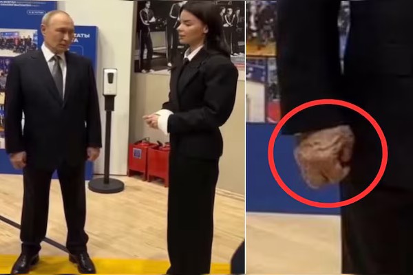 புடின் கைகளுக்கு என்ன ஆனது? மீண்டும் தலைதூக்கிய உடல்நிலை குறித்த ஊகங்கள் | Putins Hand Medical Conditions Viral Speculation