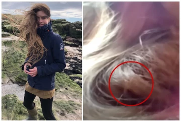 இளம் அழகியின் கூந்தலில் 84 நாட்கள் வாழ்ந்த பறவை! அதிசய சம்பவம்