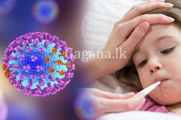 මෙරට දරුවන් අතර ව්‍යාප්ත වන වෛරසයක් ගැන සෞඛ්‍ය අංශ වලින් අනතුරු අඟවයි.