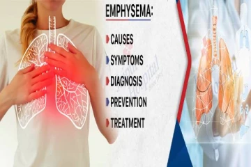 emphysema symptoms: நுரையீரல் அடைப்பு நோயின் அறிகுறிகள் என்ன? எவ்வாறு தடுப்பது?