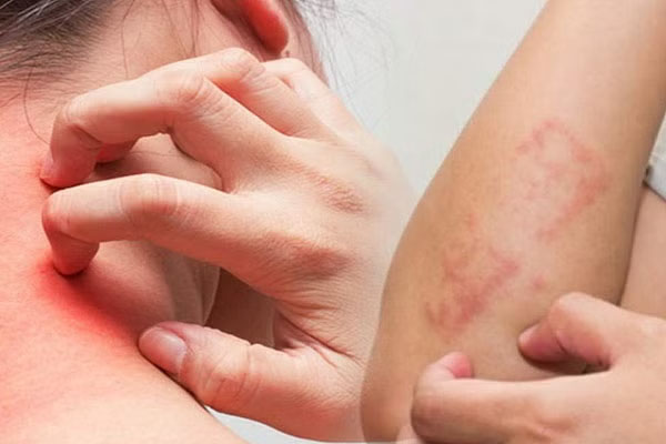 பிரியாணியில் சேர்க்கப்படும் இந்த பொருளில் இத்தனை நன்மைகளா? | Benefits Of Star Anise