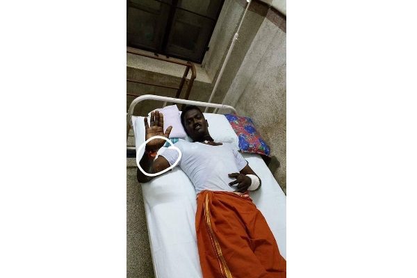 “நான் தான் வாவா சுரேஷ்” மருத்துவரிடம் திணறியபடி பேசிய பாம்பு பிடி மன்னன்; வீடு திரும்புவது எப்போது? | Vava Suresh Cured From Snake Hospitel Discharge