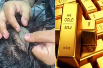 அயன் பட ஸ்டைலில் தலையில் ’விக்’ வைத்து தங்கம் கடத்தல் - தலையில் இருந்து தங்கத்தை பிரித்தெடுக்கும் வீடியோ வைரல்