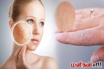 வறண்ட சருமத்திற்கான இயற்கை பராமரிப்புகள்! இந்த தவறுகளை செய்யாதீங்க