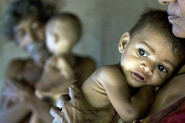 ஐந்து வயதுக்குட்பட்ட குழந்தைகள் தொடர்பில் வெளியான தகவல் | Increase In Underweight Children Five Years Of Age