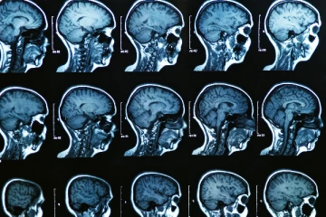 வளர்ந்து வரும் மனித மூளை., ஆராய்ச்சியாளர்களின் வியப்பூட்டும் தகவல்கள்