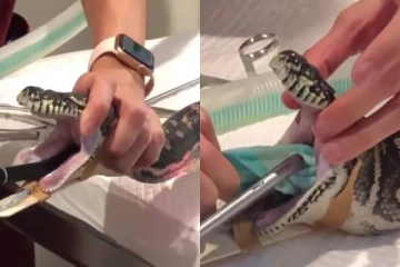 மிகப்பெரிய பொருளை விழுங்கிய மலைப்பாம்பு - உள்ளே இருந்ததை கண்டு ஆடிப்போன மருத்துவர்கள்; பதபதைக்க வைக்கும் வீடியோ!