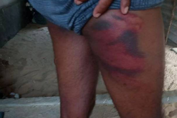 யாழில் மீனவர் ஒருவரை மூர்க்கத்தனமான தாக்கிய மர்ம நபர்கள்! | Fake Military Intelligence Attack Jaffna Fisher யாழில் மீனவர் ஒருவரை மூர்க்கத்தனமான தாக்கிய மர்ம நபர்கள்! | Fake Military Intelligence Attack Jaffna Fisher