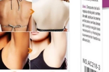 සුදු වීමට භාවිතා කරන ක්‍රීම් ගැන හෙළිවූ භයානක දේ - ඔබටත් මෙම ලක්ෂණ තිබේදැයි බලන්න..