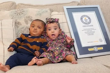 22 வாரங்களில் பிறந்த கனடா இரட்டை குழந்தைகள் கின்னஸில் இடம்பிடிப்பு!