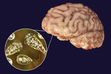 மூளையை உண்ணும் அமீபா வைரஸ்; ஒருவர் மரணம்