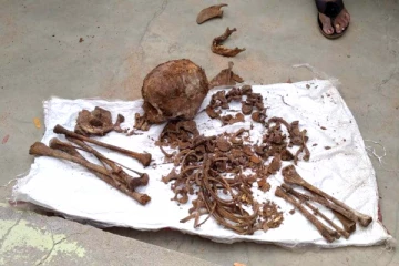 மனநலம் குன்றிய சிறுவனை அடித்துக் கொன்றதாக புகார்: எலும்புக்கூடு தோண்டி எடுப்பு