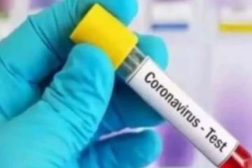 பிரபல நடிகருக்கு கொரோனா: அச்சத்தில் பாலிவுட்