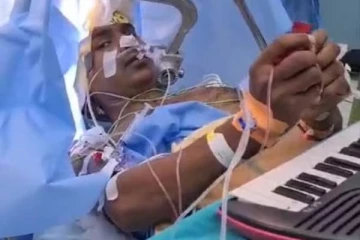 தலையை பிளந்து அறுவை சிகிச்சை - நடுவில் பியானோ வாசித்து மிரள வைத்த நோயாளி!