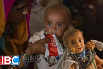 வெளிநாடொன்றில் பசியுடன் பிறக்கும் மில்லியன் கணக்கான குழந்தைகள்