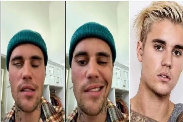 என்னால் வாயினை அசைக்க முடியவில்லை : பிரபல பாடகருக்கு நேர்ந்த பரிதாபம், சோகத்தில்  ரசிகர்கள்