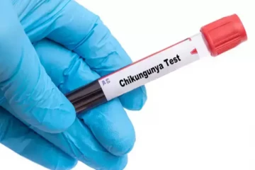 யாழில் தலைத்தூக்கும் சிக்கன்குனியா ; மக்களே அவதானம்