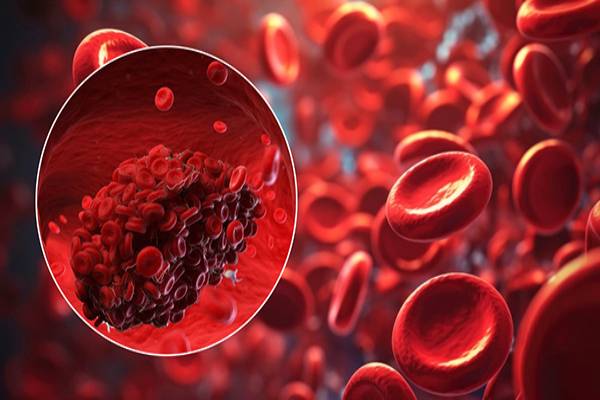 உடலில் இரத்தம் கெட்டியாகினால் முதலில் காட்டும் அறிகுறிகள் எவை? | Thick Blood Side Effects Warning Signs