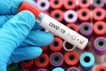 நாட்டில் கோவிட் தொற்றாளர் எண்ணிக்கை அதிகரிப்பு