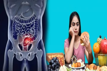 செயற்கை உணவுகளால் காத்திருக்கும் ஆபத்து ; தீவிரமடையும் குடல் நோய் குறித்து மருத்துவர்கள் எச்சரிக்கை