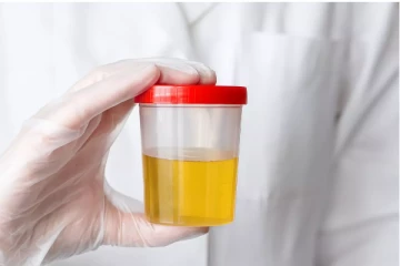 சிறுநீர் மஞ்சளாக இருப்பது ஏன்? 150 ஆண்டுகளாக விடைதெரியாத கேள்விக்கு விடை கண்டுபிடித்துள்ள அறிவியலாளர்கள்...