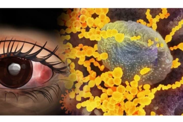 பேராபத்து விளைவிக்கும் மஞ்சள் பூஞ்சை நோய் எப்படி பரவுகிறது? யாரையெல்லாம் தாக்கும்?