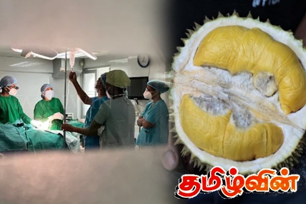 குடும்பஸ்தரின் உயிரை பறித்த தூரியன் | Man Dies After Getting Durian Seed Stuck In Throat