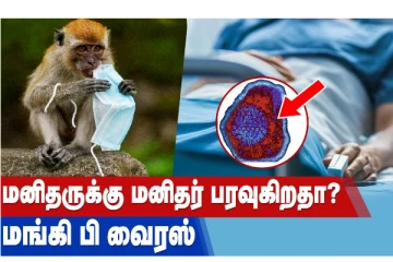 மனிதருக்கு மனிதர் பரவுகிறதா? ‘மங்கி பி’ வைரஸ்