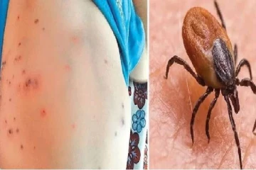 புதிய வகை தொற்றால் தமிழகத்தில் 5,000 பேர் பாதிப்பு