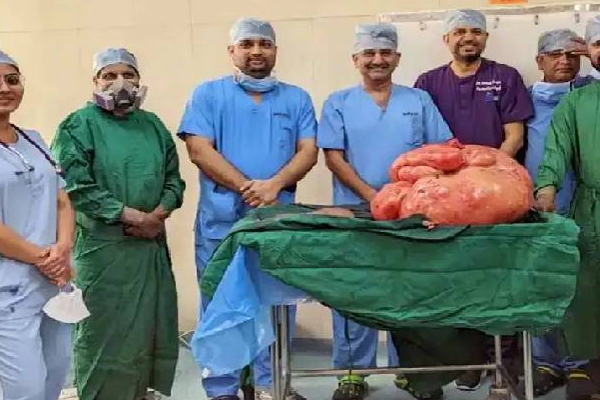 47 கிலோ கட்டியோடு 18 வருடம் வாழ்ந்து வந்த பெண்! இந்தியாவில் மருத்துவர்கள் படைத்த சாதனை | India Gujarat Treatment Doctor Achievement Surgery