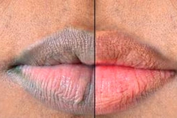 கருப்பு உதடுகள் சில நாட்களில் இளஞ்சிவப்பு நிறமாக மாறும், இதை முயற்சிக்கவும்