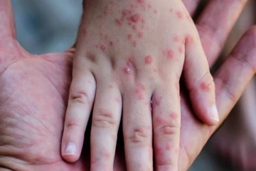 பிரித்தானியா முழுவதும் விடுக்கப்பட்டுள்ள சுகாதார எச்சரிக்கை!