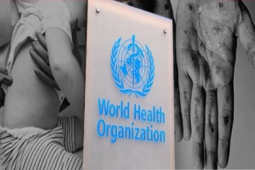 தாண்டவமாடும் குரங்கம்மை திரிபு - விஞ்ஞானிகள் எச்சரிக்கை!