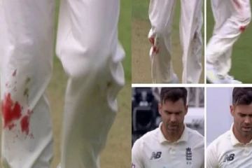 " மாப்பிள்ளைக்கு அவ்வளவு வெறி" - காலில் ரத்தம் சொட்ட சொட்ட பந்து வீசிய ஆண்டர்சன்..!