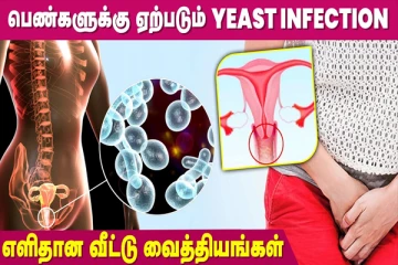 பிறப்புறுப்பில் அரிப்பு இருக்கா; அப்போ இதை மட்டும் ட்ரை பண்ணி பாருங்க