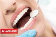 தாங்க முடியாத வலியை தரும் பல் சொத்தை! வாழ்நாள் முழுக்க அது ஏற்படாமல் தடுப்பது எப்படி? இதை செய்யுங்கள்