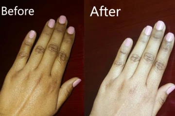 உங்கள் கை, கால் கருப்பா இருக்கா? இதனை போக்க இதோ சூப்பர் 10 டிப்ஸ்!