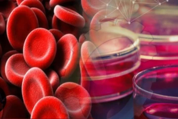 අතිශය දුර්ලභ ලේ වර්ගයක් සොයා ගැනේ..