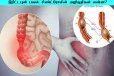 Irritable Bowel Syndrome: டீன் ஏஜில் வயிற்றில் இந்த பிரச்சனை ஏற்படுகின்றதா? அலட்சியம் வேண்டாம்
