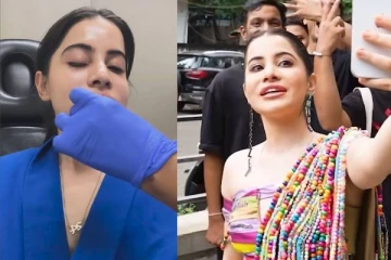 முகம் வீங்கி மோசமான தோற்றம்!! உதட்டில் ஊசிப்போட்ட நடிகை உர்ஃபிக்கு ஏற்பட்ட பின்விளைவுகள்..